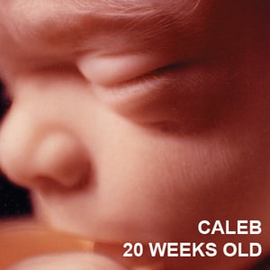 I AM HUMAN - Caleb 20 Weeks Old